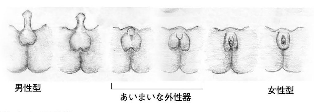 第８章 ヒトの性 典型的な男 女とは 一色出版